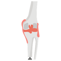 Genou humain artificiel  Icône
