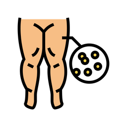 Edema hipoproteinémico  Icono