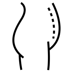 Bauchoperation  Symbol