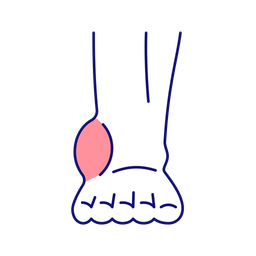 Ankle inflammation  Icon